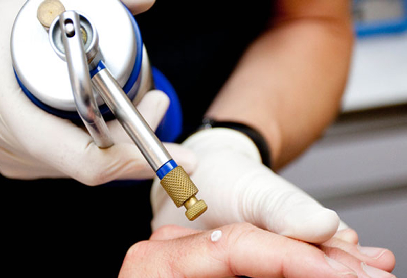 کاربردهای کرایوتراپی در درمان بیماری‌های پوستی